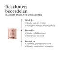 Imby Skin Health supplement voor honden, ondersteunt de algemene gezondheid en dagelijkse vitaliteit, helpt het immuunsysteem en een gezonde huid en vacht te behouden, vult voedingshiaten in de dagelijkse voeding aan, uitgebalanceerde formule ontwikkeld door dierenartsen geschikt voor dagelijks gebruik. | localization: NL